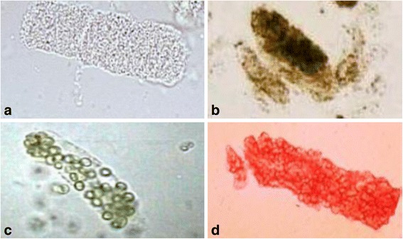 Comparison panel of renal tubular epithelial, granular, WBC and RBC casts