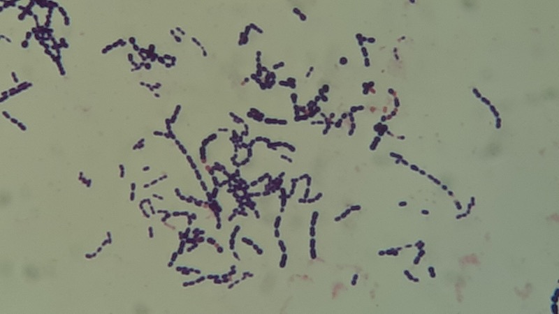 Gram stain of Streptococcus in chains