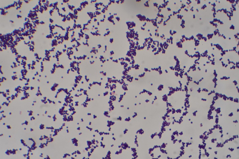 Gram stain of Staphylococcus aureus clusters