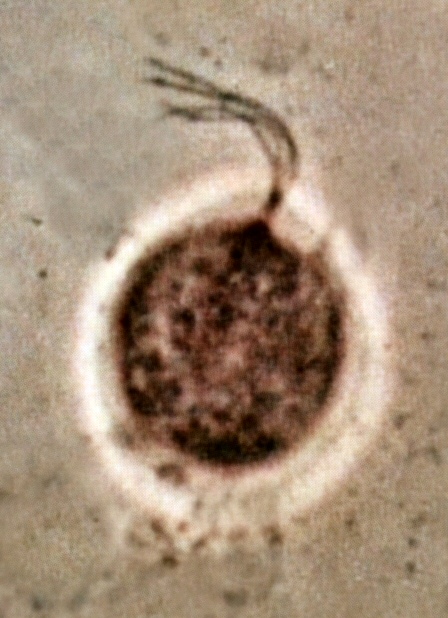 Trichomonas vaginalis phase contrast microscopy