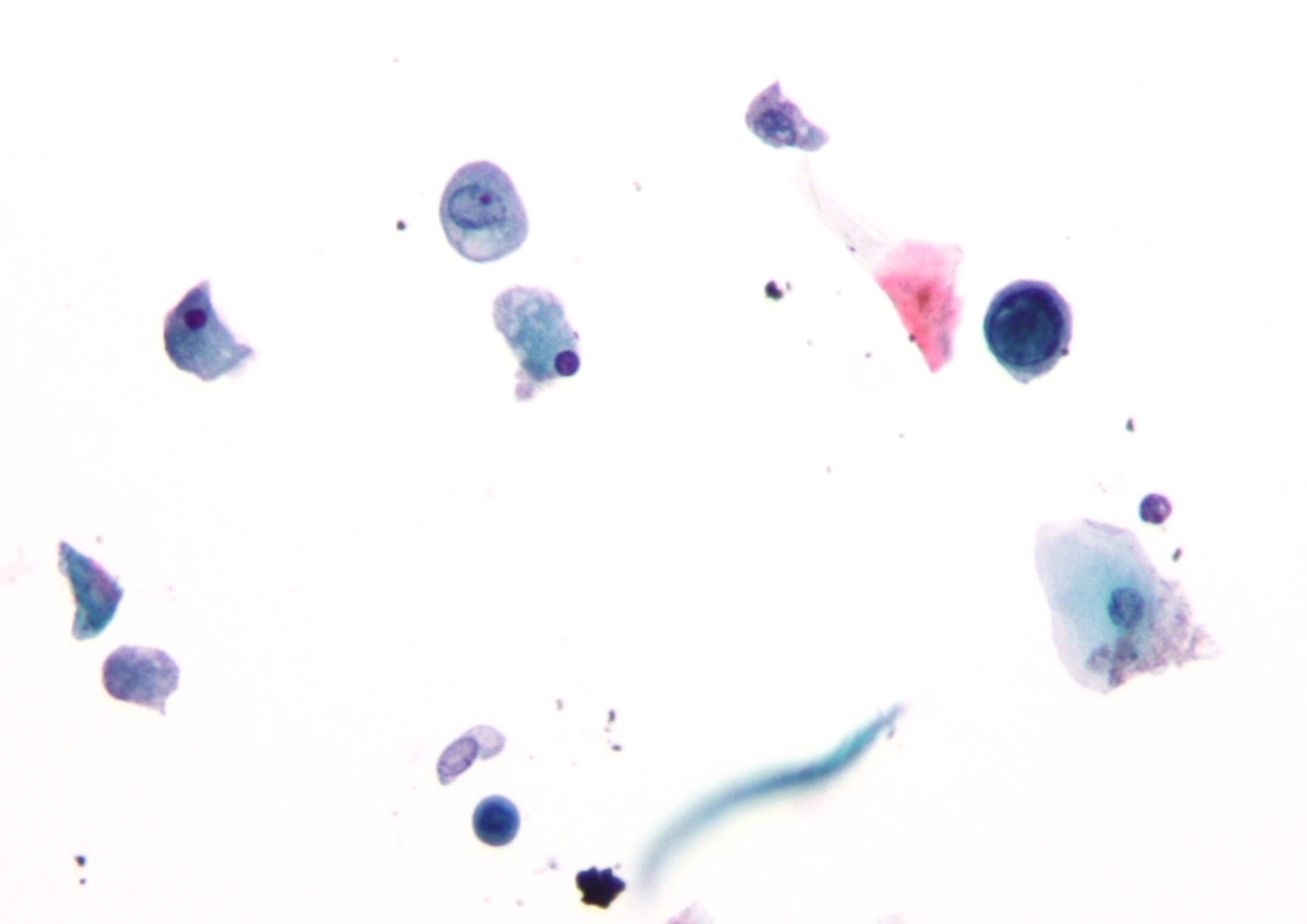 Polyomavirus EM