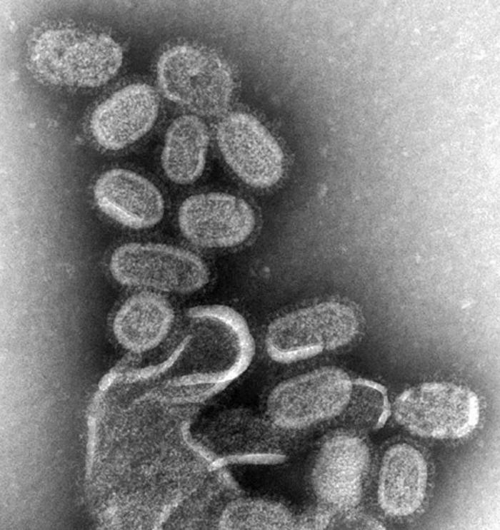 Influenza virus electron micrograph