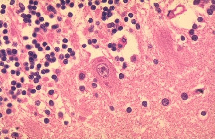Negri bodies in Purkinje cells
