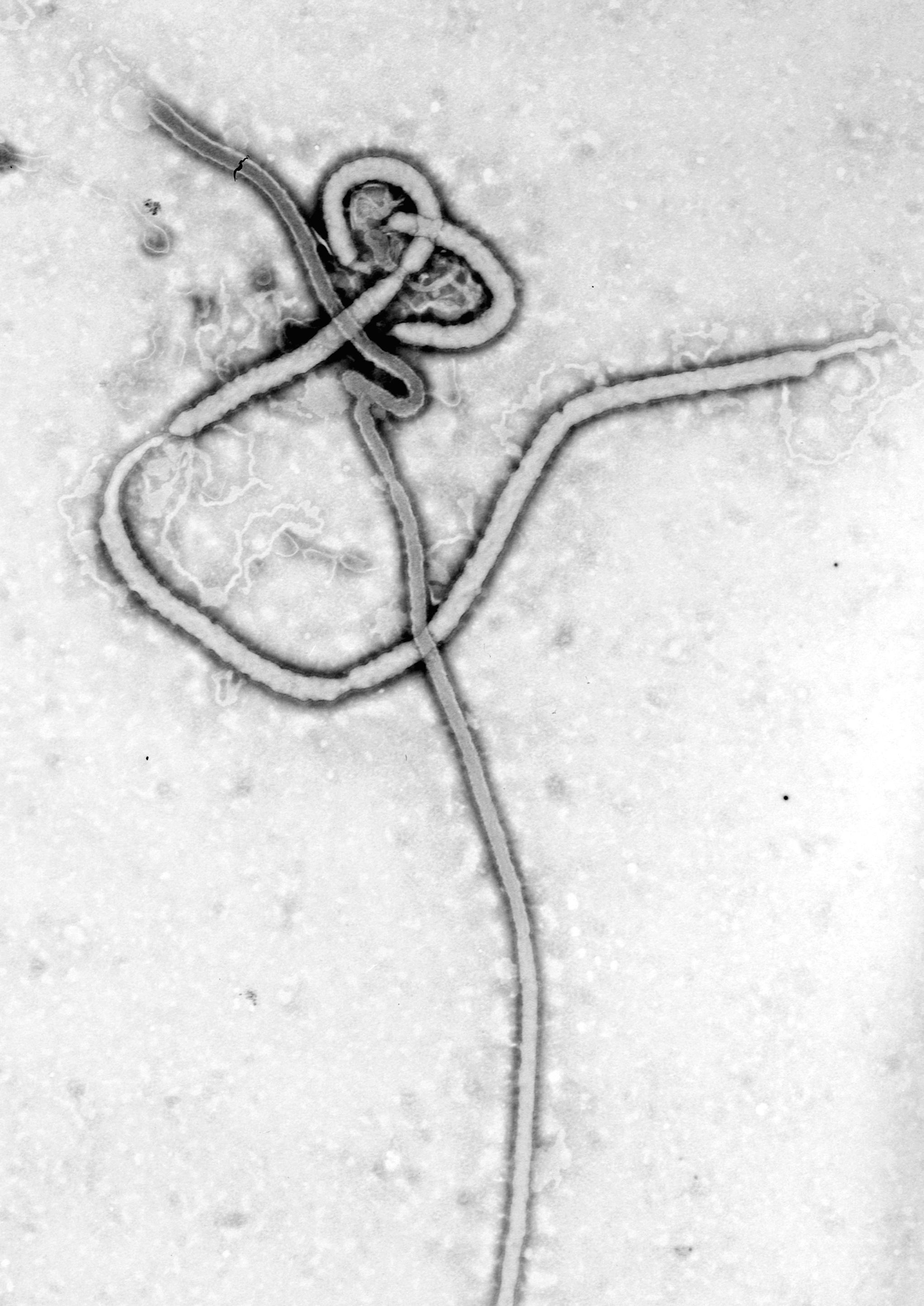 Ebola virus filamentous EM