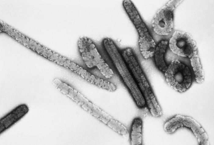 Marburg virus EM