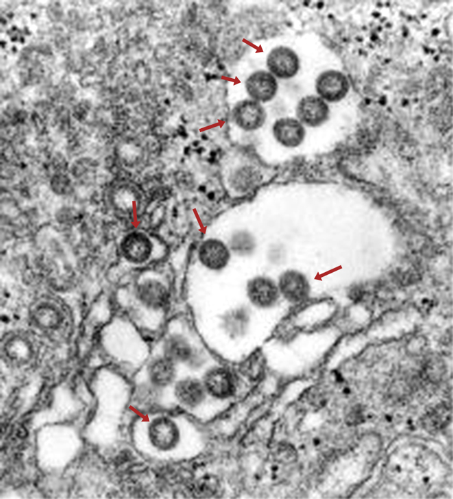 Rift Valley fever virus EM