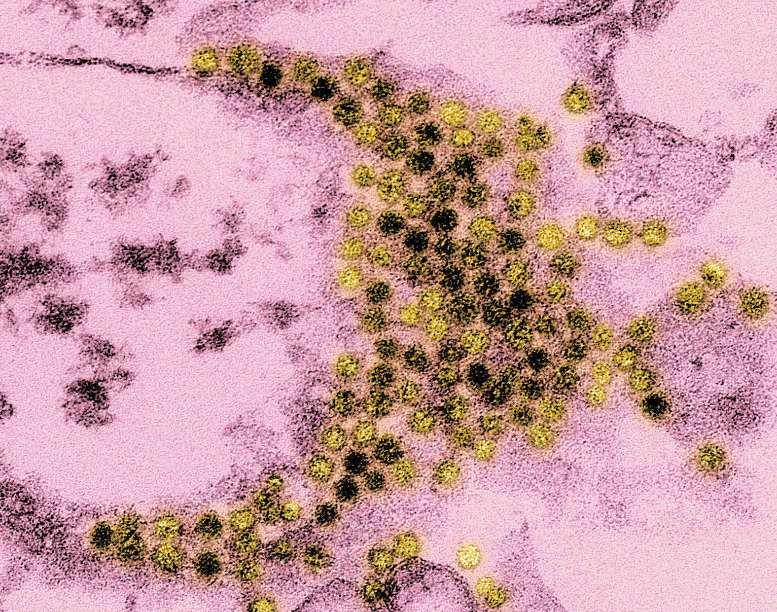 Enterovirus EM