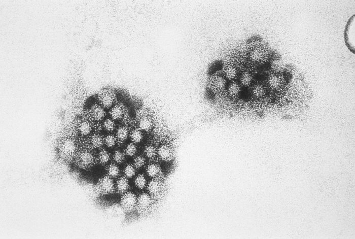 Norovirus electron micrograph