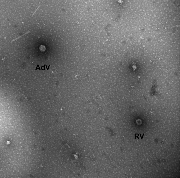 Adenovirus seen on electron microscopy in enteric infection