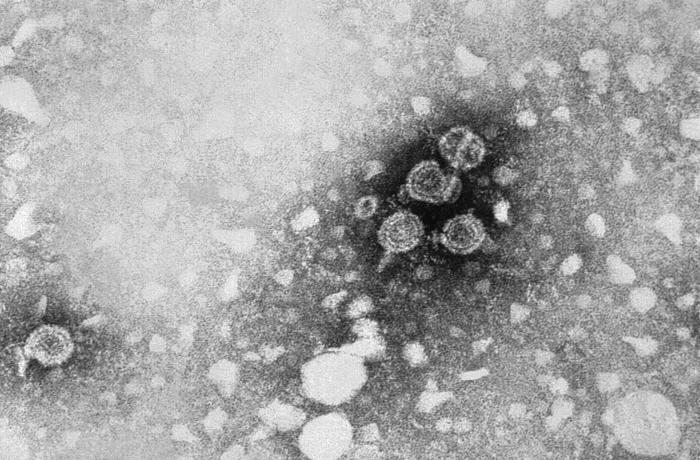 Dane particles (HBV virions) EM