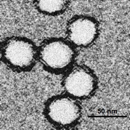 West Nile virus electron micrograph