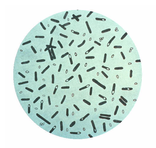 Clostridium botulinum gram stain